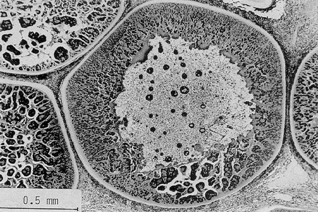 LymphoD7.gif